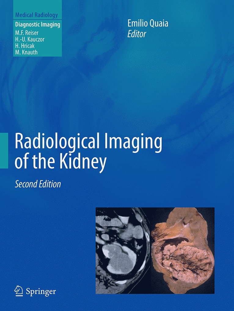 Emilio Quaia - Radiological Imaging of the Kidney, Häftad