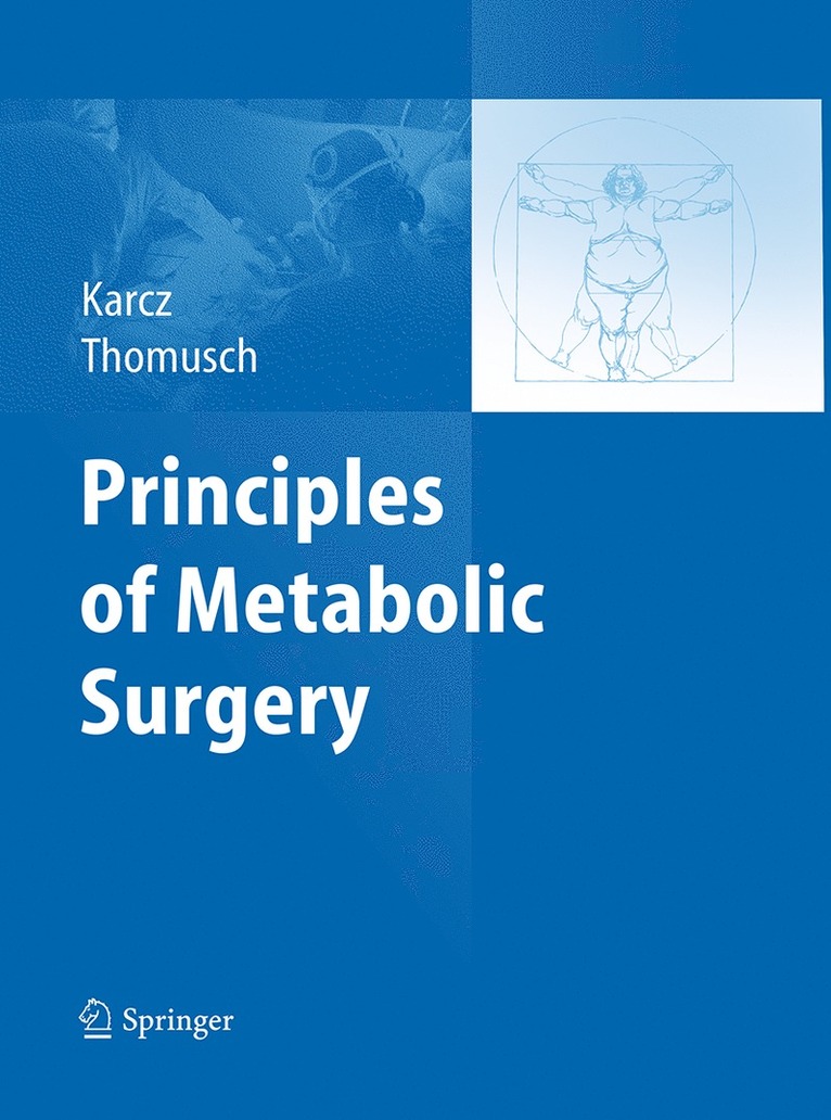Konrad Karcz, Oliver Thomusch - Principles of Metabolic Surgery, Häftad
