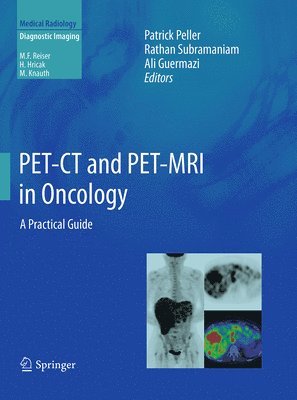 bokomslag PET-CT and PET-MRI in Oncology