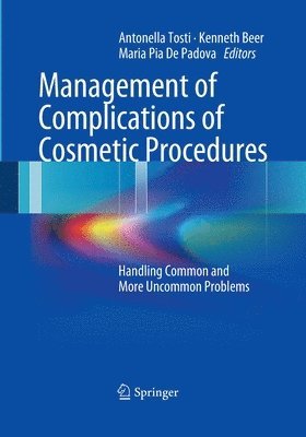 Antonella Tosti, Kenneth Beer, Maria Pia De Padova - Management of Complications of Cosmetic Procedures, Häftad