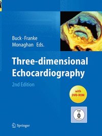 bokomslag Three-dimensional Echocardiography