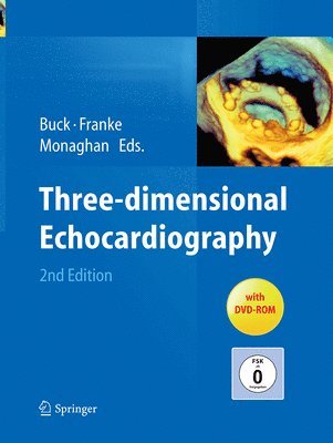 Three-dimensional Echocardiography 1