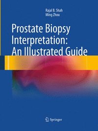 bokomslag Prostate Biopsy Interpretation: An Illustrated Guide