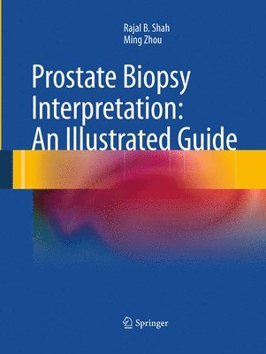 Prostate Biopsy Interpretation: An Illustrated Guide 1