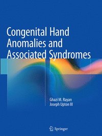 bokomslag Congenital Hand Anomalies and Associated Syndromes