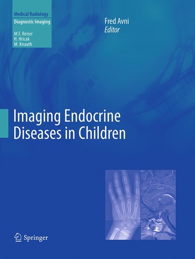 bokomslag Imaging Endocrine Diseases in Children