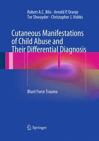 bokomslag Cutaneous Manifestations of Child Abuse and Their Differential Diagnosis