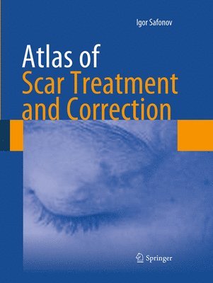 bokomslag Atlas of Scar Treatment and Correction