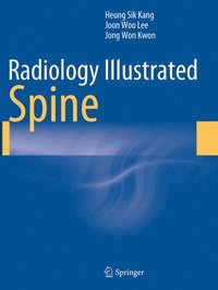 bokomslag Radiology Illustrated: Spine