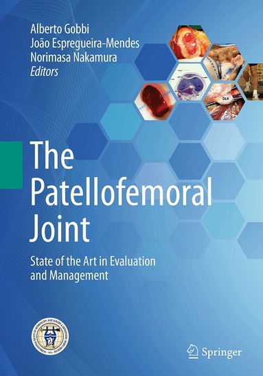 Alberto Gobbi, João Espregueira-Mendes, Norimasa Nakamura - Patellofemoral Joint, Häftad
