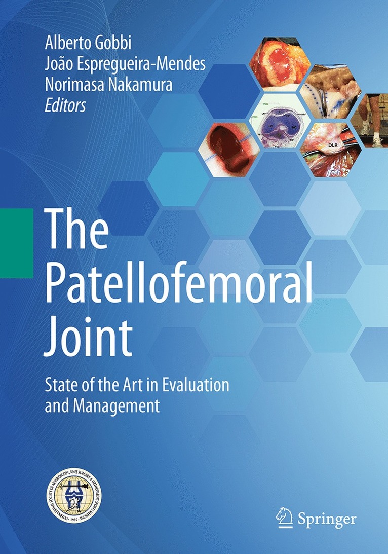 Alberto Gobbi, João Espregueira-Mendes, Norimasa Nakamura - Patellofemoral Joint, Häftad