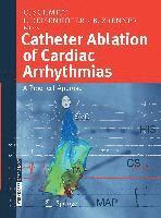 Catheter Ablation of Cardiac Arrhythmias 1