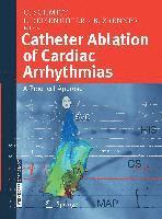 C. Schmitt, I. Deisenhofer, B. Zrenner - Catheter Ablation of Cardiac Arrhythmias, Häftad. Tillgänglighet: Lägg i varukorg