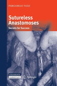 bokomslag Sutureless Anastomoses