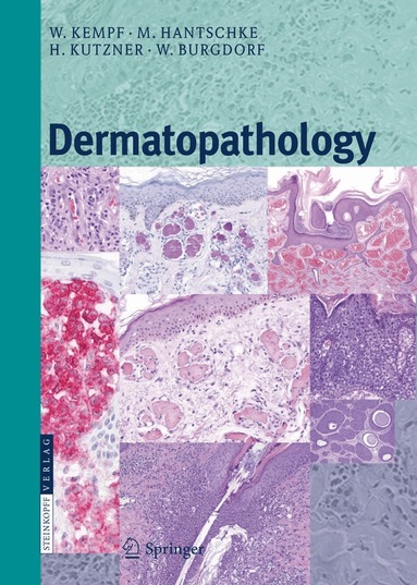 Werner Kempf, Markus Hantschke, Heinz Kutzner, Walter H.C. Burgdorf - Dermatopathology, Häftad