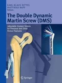 bokomslag The Double Dynamic Martin Screw (DMS)
