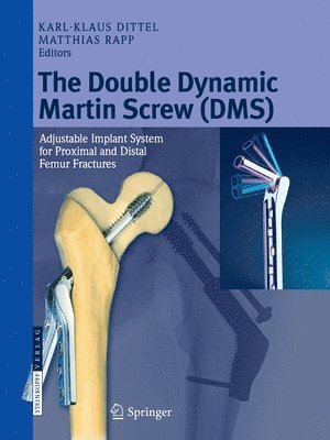 The Double Dynamic Martin Screw (DMS) 1