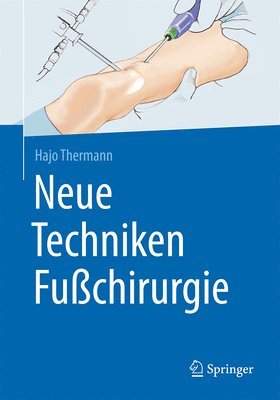 bokomslag Neue Techniken Fußchirurgie