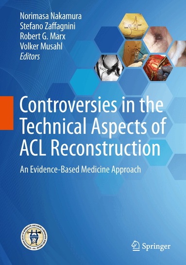Norimasa Nakamura, Stefano Zaffagnini, Robert G. Marx, Volker Musahl - Controversies in the Technical Aspects of ACL Reconstruction, Inbunden