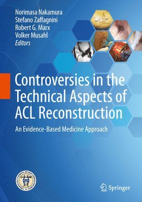 Controversies in the Technical Aspects of ACL Reconstruction 1