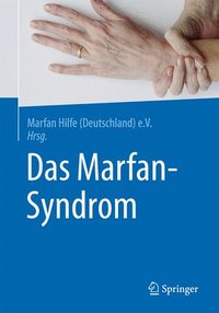 bokomslag Das Marfan-Syndrom