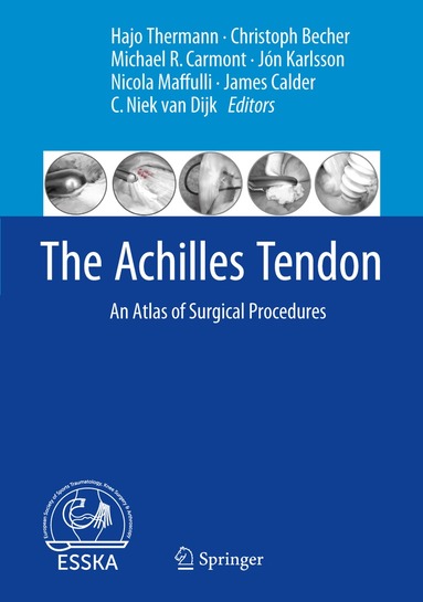 Hajo Thermann, Christoph Becher, Michael R. Carmont, Jón Karlsson, Nicola Maffulli, James Calder, C. Niek van Dijk - Achilles Tendon, Inbunden