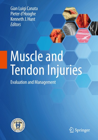 Gian Luigi Canata, Pieter d'Hooghe, Kenneth J. Hunt - Muscle and Tendon Injuries, Inbunden