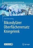 bokomslag Bikondylärer Oberflächenersatz Kniegelenk