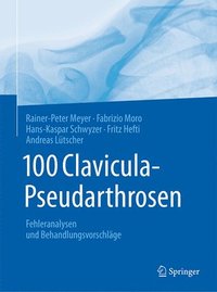 bokomslag 100 Clavicula-Pseudarthrosen