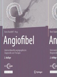 bokomslag Angiofibel