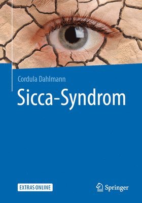 bokomslag Sicca-Syndrom