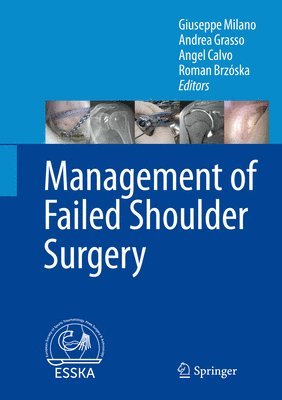 Management of Failed Shoulder Surgery 1