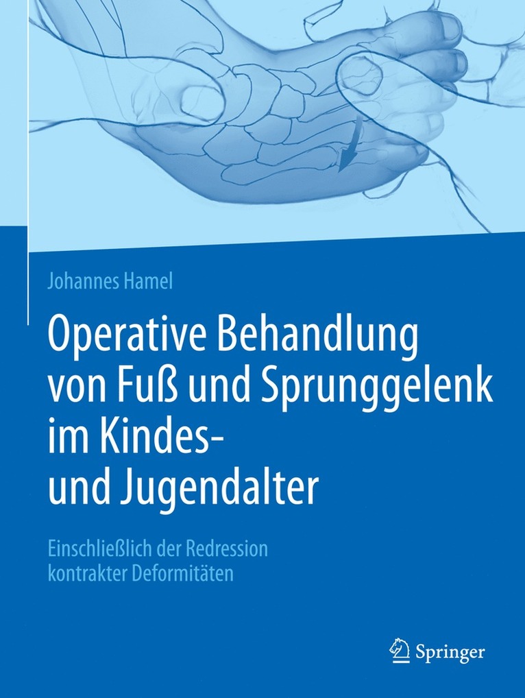 Johannes Hamel - Operative Behandlung von Fuß und Sprunggelenk im Kindes- und Jugendalter, Inbunden