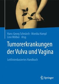 bokomslag Tumorerkrankungen der Vulva und Vagina