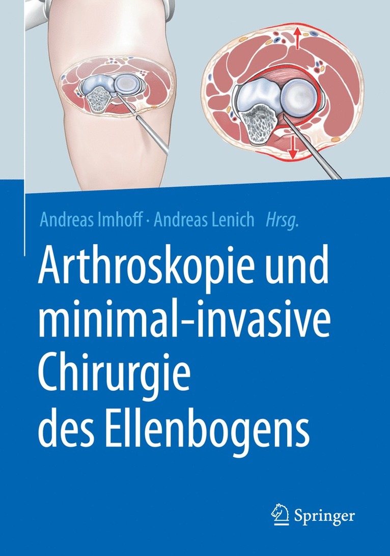 Andreas B. Imhoff, Andreas Lenich - Arthroskopie und minimal-invasive Chirurgie des Ellenbogens, Inbunden