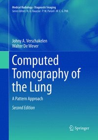 bokomslag Computed Tomography of the Lung