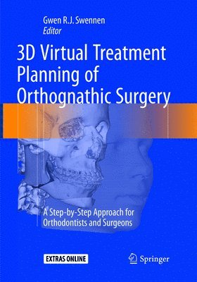 bokomslag 3D Virtual Treatment Planning of Orthognathic Surgery