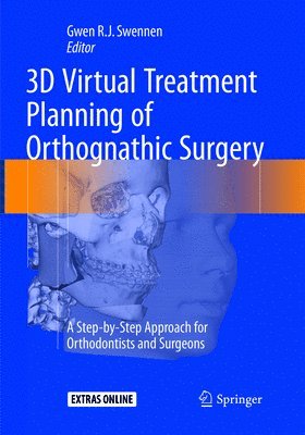3D Virtual Treatment Planning of Orthognathic Surgery 1