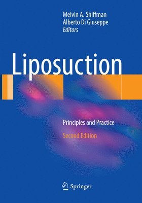 Liposuction 1