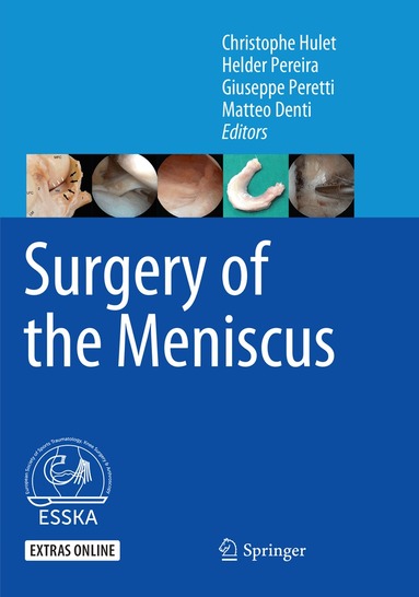 Christophe Hulet, Helder Pereira, Giuseppe Peretti, Matteo Denti - Surgery of the Meniscus, Häftad