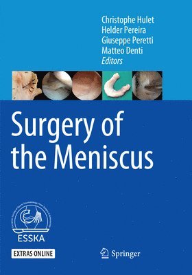 bokomslag Surgery of the Meniscus