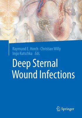 bokomslag Deep Sternal Wound Infections