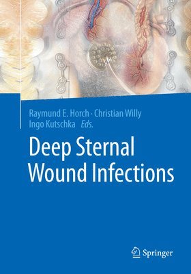 Deep Sternal Wound Infections 1