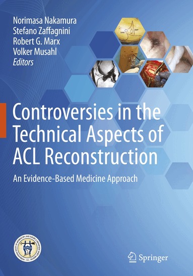 Norimasa Nakamura, Stefano Zaffagnini, Robert G. Marx, Volker Musahl - Controversies in the Technical Aspects of ACL Reconstruction, Häftad