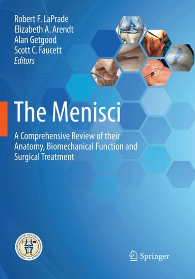 Robert F. LaPrade, Elizabeth A. Arendt, Alan Getgood, Scott C. Faucett - Menisci, Häftad