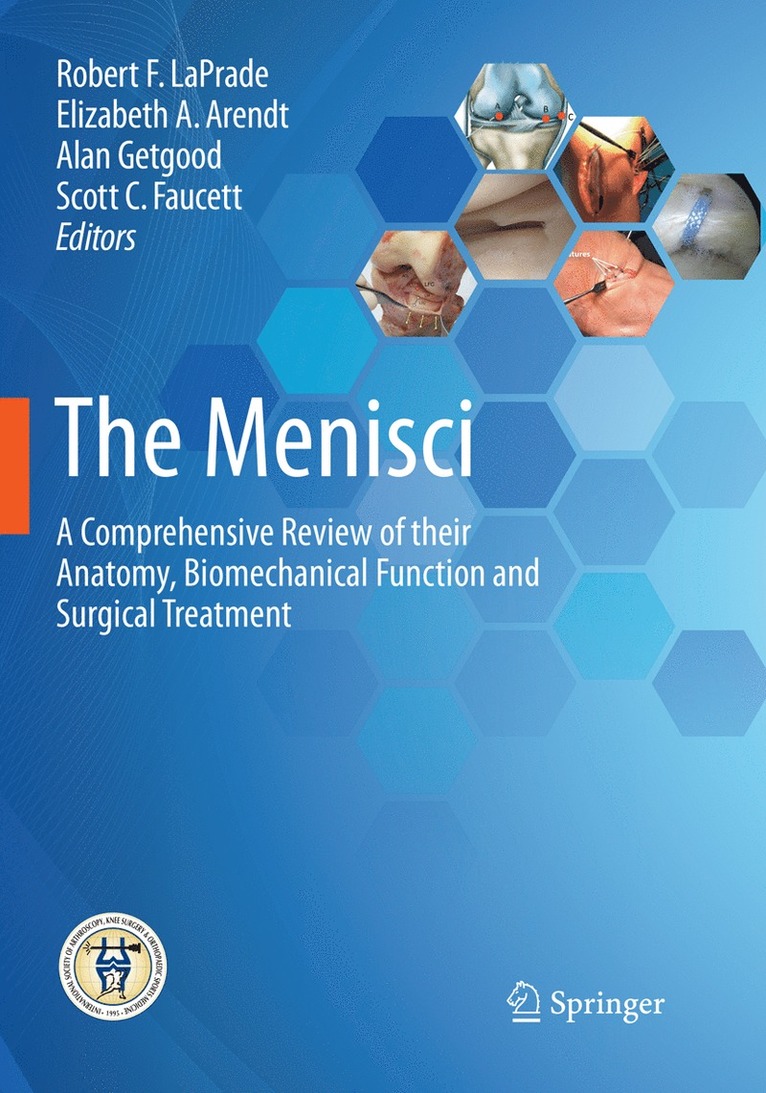 The Menisci 1