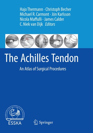 Hajo Thermann, Christoph Becher, Michael R. Carmont, Jón Karlsson, Nicola Maffulli, James Calder, C. Niek van Dijk - Achilles Tendon, Häftad