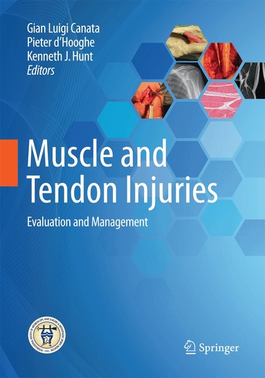 Gian Luigi Canata, Pieter d'Hooghe, Kenneth J. Hunt - Muscle and Tendon Injuries, Häftad