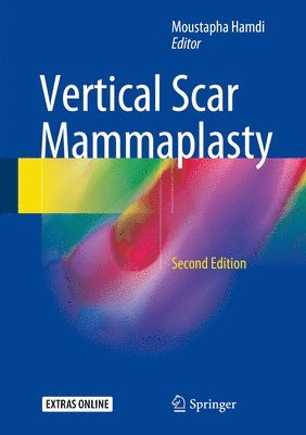 Vertical Scar Mammaplasty 1
