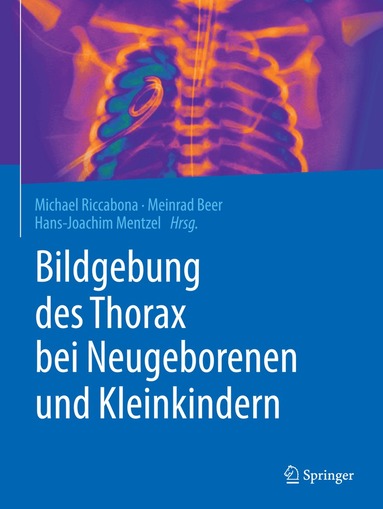 Michael Riccabona, Meinrad Beer, Hans-Joachim Mentzel - Bildgebung des Thorax bei Neugeborenen und Kleinkindern, Inbunden